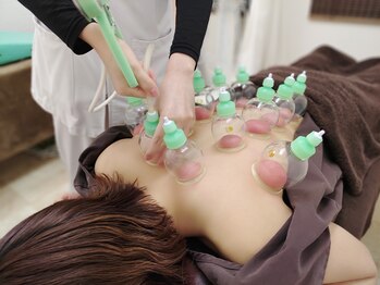 メディカル整体院 しろくま堂/カッピング・吸玉で血流改善
