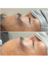 エンルーチェ プラスエイト(en;Luce+8)/HBLアイブロウ(眉毛パーマ&WAX)