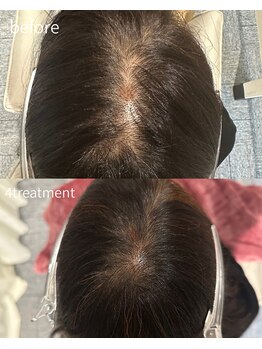 カラーズ(COLOURS)/プロセルセラピーズ頭皮