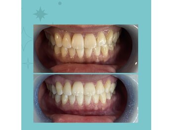 クリスタルホワイト(CRYSTAL white)