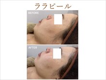 ティアム バイ テトテ 神戸三宮(TIAM by tetote)/ララピール