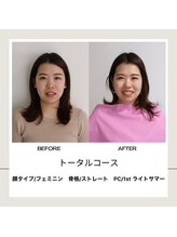 シュアリー(Surely)/トータルコースお客様事例