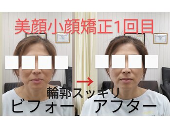 ないとう健身整体/美顔小顔調整