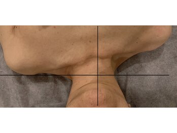 ハイナ 恵比寿店(Hi-Na)/恵比寿/フェイシャル/ブライダル