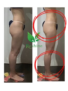 リシャイン(Reshine)/ブライダルダイエット