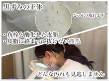 エミュ(emu)の雰囲気（汚れを拡大！いらない汚れは全て回収いたします）