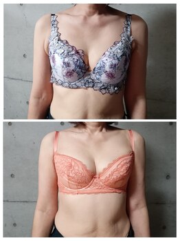 ミラクルバスト 松山店/