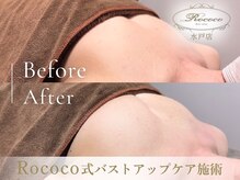 ロココ 水戸店(Rococo)/BEFORE/AFTER