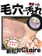 クレール 新松戸(Claire)/毛穴つるん♪毛穴ケア/角栓取り