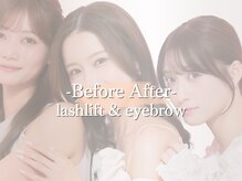 アイロジック/まつげ眉毛BA[マツパ/眉毛]