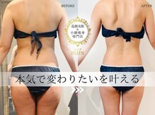 エステビジン 八事(エステBIZIN)