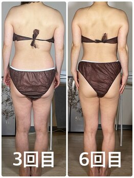 サロン ド サッコ(salon de sacco)/【6回終了後】ビフォーアフター