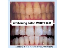 ホワイトニングサロン ホワイト(WHITE)/セルフホワイトニング/大阪/福島