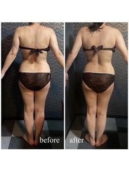 ラクラク(rakuraku)/痩身【全身】90分(1回目)