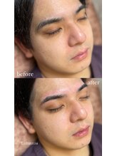 エナ バイ アオヒゲ(ena by AOHIGE)/メンズ眉毛/アイブロウ