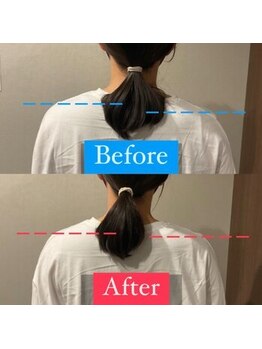 ナオル整体 宮崎院(NAORU整体)/20代女性施術事例【肩の高さ】