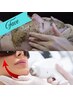 【美肌】ハーブピーリング＆即効性光リフトの夢のWケア！¥25,800→