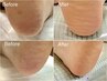 【お試し】かかとの角質ケアのみ30分¥5500ライトな症状な方へおすすめ！