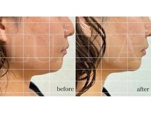 ルアナ(LUANA)/レモンボトル