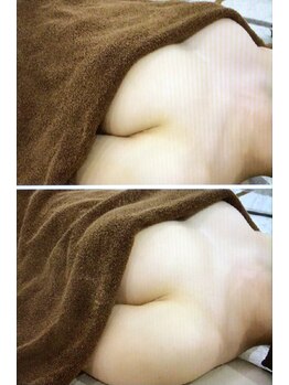 サロン アイミー(salon i me)/【バストアップ】症例