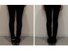 スラっと美脚にO脚改善コース《冷えむくみ改善》通常¥11000円→¥2980円