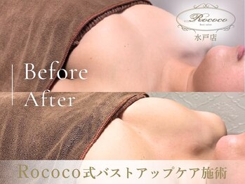 ロココ 水戸店(Rococo)/BEFORE/AFTER