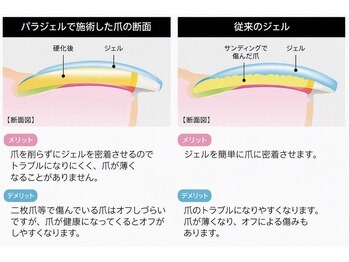 エン 中崎町(enn.)/パラジェルとは?