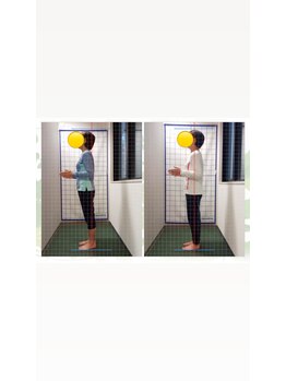 キンマク 仙台駅前院(KINMAQ)/姿勢のBefore&After