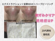 ミラ(Mira...)/☆Before→After☆