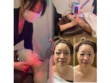 モコ(moco)の雰囲気（肌不調.眼精.脳疲労.首肩コリスッキリ！経絡フェイシャル♪）