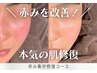 ＜赤みにお悩みの方｜HPB限定4回コース＞赤み集中修復コース〈敏感・乾燥肌〉