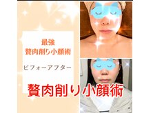 ドクターマジックタッチ(Dr.MAGIC TOUCH)/【劇的小顔術】ビフォーアフター