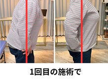 パーソナル整体 チェンジ(CHANGE)/Before After