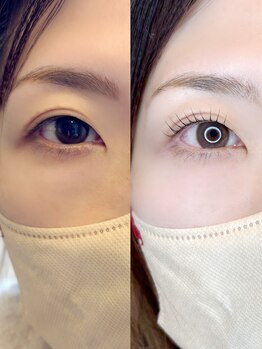 グロウビューティー(grow beauty)/