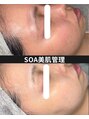 韓国肌管理室 ソア(soa)&nbsp;施術×お客様の生活やホームケアまで一緒に見直した結果。|赤み
