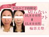 【平日限定】人気No,1メニュー切らない小顔リフトを168,00→15,800円でお試し
