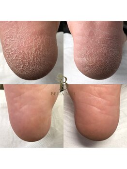 足先をとことん美人に☆