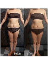 ラクラク(rakuraku)/痩身【全身】９０分（１回目）