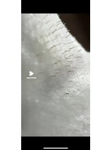 トゥルーリー(TRULY)/お顔のケア大丈夫？