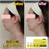 シャトン ボーテ(chaton beaute)