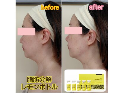 シャトン ボーテ(chaton beaute)の写真