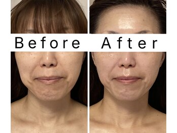 アンシャンテ(Enchant)/やさしく整える大人の小顔エステ