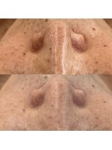 ヴェルシック(Belchic)/毎回、目に見える変化と肌触り