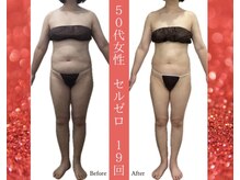 ムーン 高崎店(MOON)/５０代女性　無理せず痩身エステ