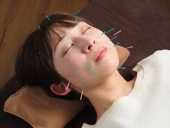 ハリラボ 仙台 長町(hari Lab.)の写真/著名人絶賛!!新世代のエイジングケア成分【エクソソーム】と美容鍼による小顔・美肌の至高ケア◇初回￥3980
