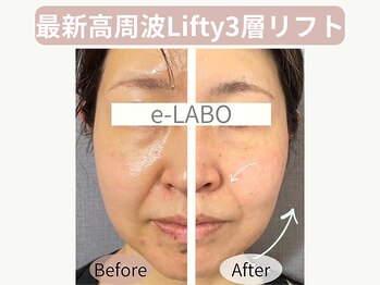 イーラボ 池袋店(e-LABO)の写真/エステで叶う、憧れの小顔!たるみ・もたつき改善で、キュッと引き締まった印象に◎
