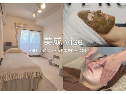 美成(vise)の写真