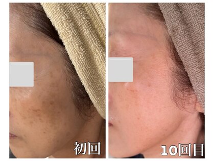 からだ美人 ヘッドスパ 鹿児島の写真