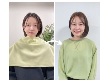 エピファニー 東京 銀座/ビフォーアフター(N.K様 30代)