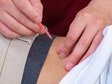 てて整骨院 針ヶ谷店/施術の様子